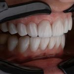 Werribee dentistry