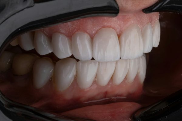 Werribee dentistry